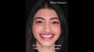 Alana's Smile Makeover with Dr. Pasha