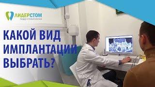 Виды имплантации зубов.  Подробно о всех видах и этапах имплантации зубов. ЛидерСтом. 12+