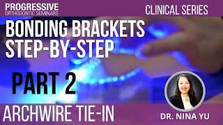 Bonding Brackets: Step-By-Step with Dr. Nina Yu (Part 2)