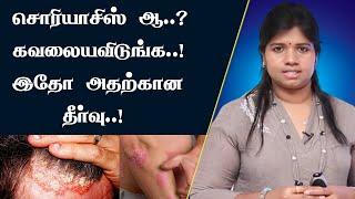 சொரியாசிஸ் பிரச்சனைக்கு நிரந்தர தீர்வு | Psoriasis Symptoms Causes & Treatment | Dr. B.Yoga Vidhya