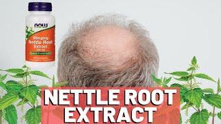 Nettle Root Extract: How Does It Work For Hair Loss?