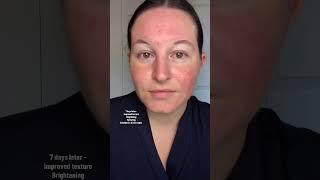 before using this eye cream #ksecret #eyecream #retinal #beauty #skincare