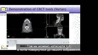 Session 11 - IGRT: Image-Matching Workshop in CBCT