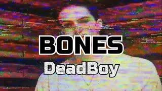 Bones - DeadBoy (RUS SUB)