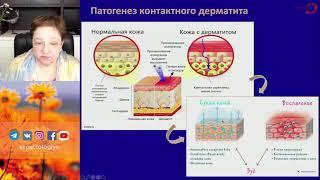 Экспертология | Зуд вульвы