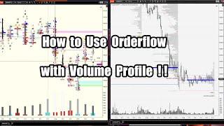 How to use Orderflow with Volume Profile !!