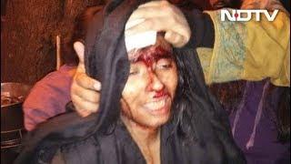 Watch: "I Am Bleeding," Says Badly Injured JNU Students' Union President