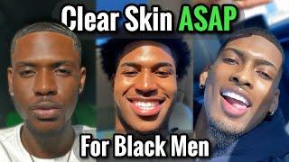 How to Get Clear Skin ASAP for Black Men