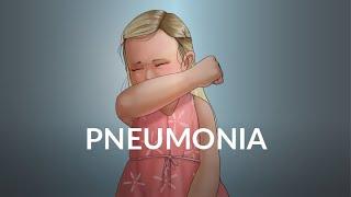 Pneumonia by B. Fissel, P. Stoeck | OPENPediatrics