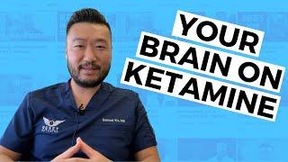 How Ketamine Transforms Your Brain