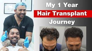 Best Cost of Hair Transplant in Mumbai: Do your research! #hairtransplantcost