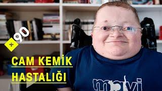 Cam kemik hastalığıyla yaşamak | "Kendi hayatımın anlamını kendim yaratmaya çalışıyorum"