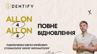 Поради від Доктора Стоматології Dentify на Печерську: Відновлення Зубів Імплантом #стоматологія