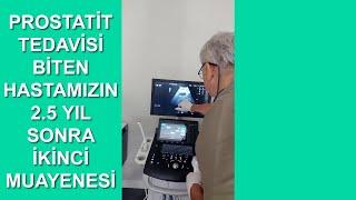 Prostatit Tedavisi Biten Hastamızın 2.5 Yıl Sonra İkinci Muayeneye Gelişi