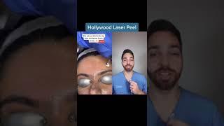 #duet with @dermwife Hollywood Laser Peel #dermatologist #skincare #laser #hyperpigmentation #melas