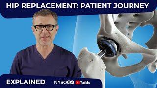 HIP REPLACEMENT SURGERY: WHAT TO EXPECT?