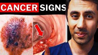 11 Hidden Cancer Signs Everyone Should Know (Doctor Explains)