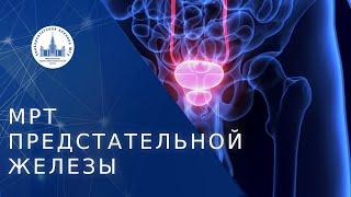  Когда показано проведение МРТ предстательной железы? МРТ предстательной железы. МНОЦ МГУ. 18+