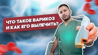 Как вылечить Варикоз ? Что такое ЭВЛК и КЛаКС (CLaCS) ?