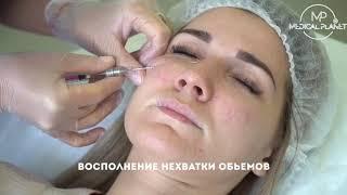 Методика full face