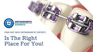 WHY YOU HAVE TO CHECK OUT ORTHODONTIC EXPERTS!!! | Orthodontist Chicago, IL