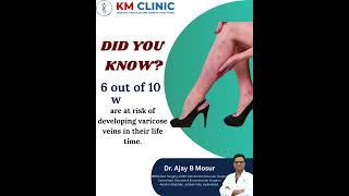 VARICOSE VEINS IN WOMEN || VARICOSE VEINS #shortsyoutube #shorts