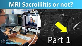 Sacroiliitis or not?  - with Prof. Hermann - Part 1