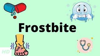 Frostbite, Causes, Signs and Symptoms, DIagnosis and Treatment.