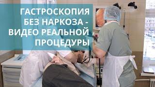  Гастроскопия без наркоза: подготовка и проведение процедуры. Гастроскопия без наркоза видео. 18+