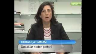 Dudak Çatlaması