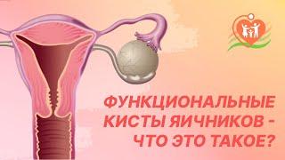  Функциональные кисты яичников - что это такое?