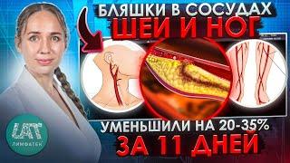 Бляшки в сосудах шеи и ног. Уменьшили на 20-35% за 11 дней