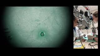 Oct 4th 2024 Class 132 Live Teaching with Alison, UW Madison Pgy 2 PRS resident