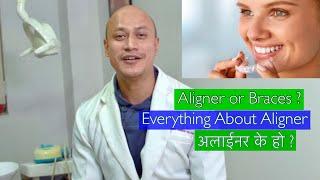 Everything you need to know about Aligner(Invisalign) - Aligner Vs Braces- Dr Bikash Dental Vlog