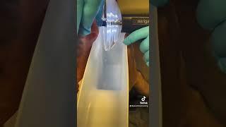 Dr. Wikoff removes a wax plug with the Earigator! #earwaxremoval #drpimplepopper #extractions