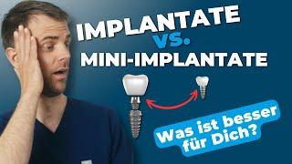 Traditionelle Implantate vs. Mini-Implantate – Was ist besser für dich?