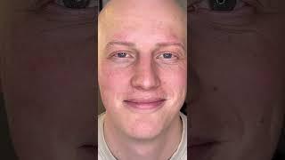 Alopecia Transformation  Hairy Stroke PMU Technique | Masterclass by @kally.co.uk