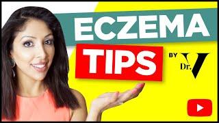 Eczema Dr Vanita Rattan | What causes eczema on hands/ face | Eczema treatment | atopic dermatitis