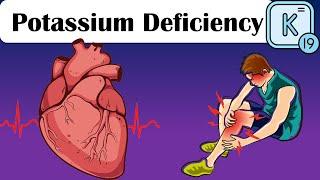 Potassium Deficiency (Low Potassium/Hypokalemia) - Causes, Signs, And Symptoms