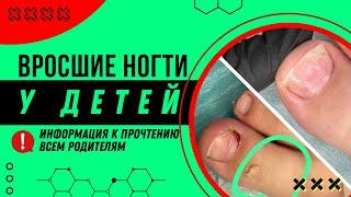 Вросшие ногти у детей! ️Информация к прочтению всем родителям