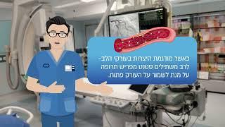 הדרכת מטופלים לקראת צנתור לב - הרצליה מדיקל סנטר