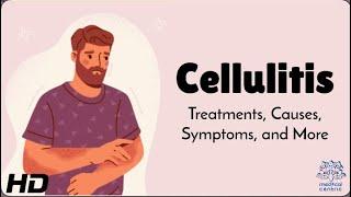 Cellulitis: How to Spot the Early Warning Signs