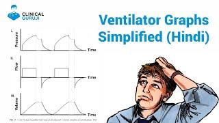 Ventilator Graphics Class - 1 (Simplified)