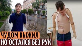 ПОТЕРЯЛ 2 РУКИ, КОГДА ЕМУ БЫЛО 9 ЛЕТ. Как сейчас живет Денис, который 7 лет назад чудом выжил.