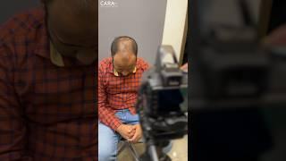 High Density Hair Transplant | Sapphire FUE Method #sapphirefue