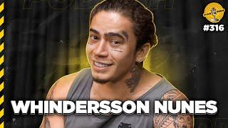 WHINDERSSON NUNES - Podpah #316