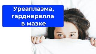 Нужно ли лечить: уреаплазма, гарднерелла в мазке?