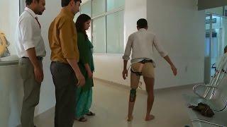 The $20 prosthetic knee that could change lives in India