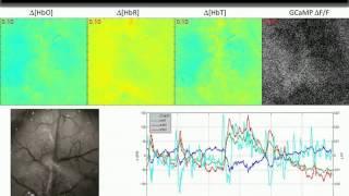 [Webinar] Multiscale Optical Imaging and Microscopy of Neurovascular Coupling in the Living Brain