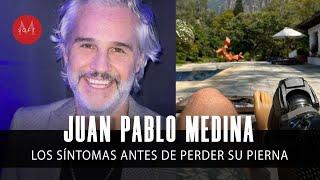 Juan Pablo Medina revela los SÍNTOMAS que tuvo antes de perder su pierna